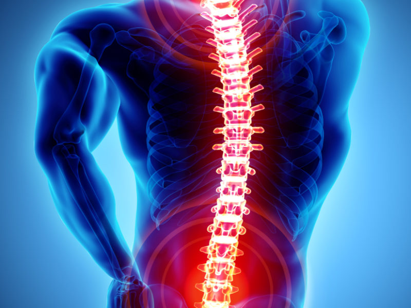 Is spinal fusion a major surgery