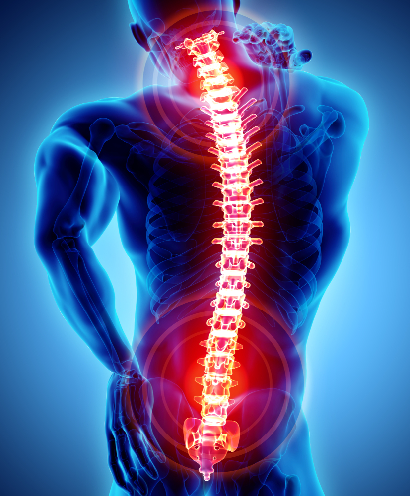 Is spinal fusion a major surgery