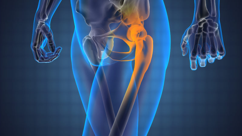best anterior hip replacement